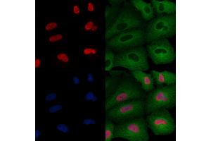 ABIN6264808 and ABIN6276442 staining  cells by IF/ICC.