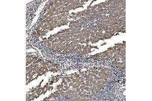 IHC analysis of Astrin/Deepest/SPAG5 using anti-Astrin/Deepest/SPAG5 antibody (ABIN7602399). (SPAG5 Antikörper  (AA 738-1193))