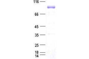 Western Blotting (WB) image for Forkhead Box P1 (FOXP1) protein (DYKDDDDK Tag) (ABIN2721379)