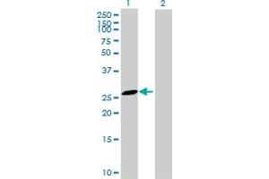 Western Blot analysis of MS4A6A expression in transfected 293T cell line by MS4A6A MaxPab polyclonal antibody. (MS4A6A Antikörper  (AA 1-248))