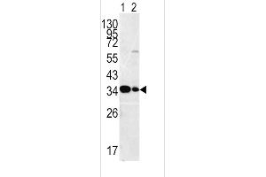Western blot analysis of ST antibody (C-term) (ABIN392001 and ABIN2841786) in HepG2ane 1nd Hela(lane2 ) cell line lysates (35 μg/lane). (MPST Antikörper  (C-Term))