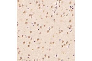 Immunohistochemistry of paraffin embedded rat brain using ALS2CR13 (ABIN7073909) at dilution of 1:1800 (400x lens) (FAM117B Antikörper)