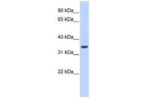 TRIM27 antibody used at 0. (TRIM27 Antikörper  (Middle Region))