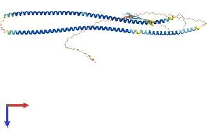 Desmin Protein (DES) (AA 1-470) (His tag)