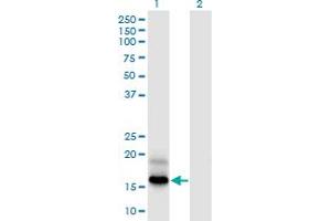 Western Blot analysis of PFDN4 expression in transfected 293T cell line by PFDN4 monoclonal antibody (M03), clone 2G4. (PFDN4 Antikörper  (AA 1-134))