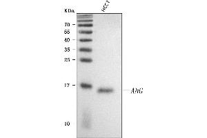 Western blot analysis of Angiogenin/ANG using anti-Angiogenin/ANG antibody (ABIN4886457). (ANG Antikörper  (AA 25-147))