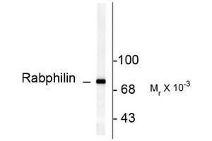 Image no. 1 for anti-Rabphilin 3A (RPH3A) (pSer234) antibody (ABIN372710) (RPH3A Antikörper  (pSer234))