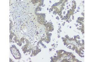 IHC analysis of GNAQ using anti GNAQ antibody (ABIN6719526).