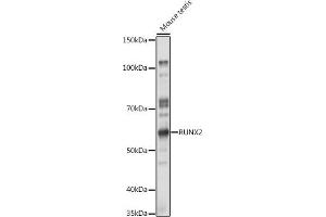 Western Blotting (WB) image for anti-Runt-Related Transcription Factor 2 (RUNX2) (AA 242-521) antibody (ABIN3016834)