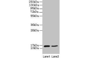 Western blot All lanes: CD59 antibody at 2 μg/mL Lane 1: Mouse heart tissue Lane 2: NIH/3T3 whole cell lysate Secondary Goat polyclonal to rabbit IgG at 1/10000 dilution Predicted band size: 15 kDa Observed band size: 15 kDa (CD59 Antikörper  (AA 26-102))