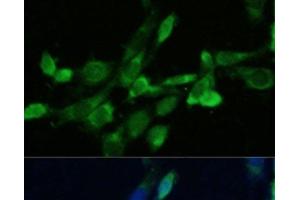Immunofluorescence analysis of NIH-3T3 cells using FDFT1 Polyclonal Antibody at dilution of 1:100. (FDFT1 Antikörper)
