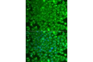 Immunofluorescence analysis of A549 cells using KBTBD7 antibody (ABIN5975133). (KBTBD7 Antikörper)