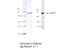 Western Blotting (WB) image for gamma Glutamyltransferase 1 (GGT1) (AA 27-569) protein (His tag) (ABIN3113071)