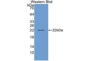 Western blot analysis of recombinant Human PGD2S. (PTGDS Antikörper  (AA 32-190))