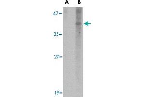 Western blot analysis of NANOS1 in SK-N-SH cell lysate with NANOS1 polyclonal antibody  at 1 ug/mL in (A) the presence and (B) the absence of blocking peptide.