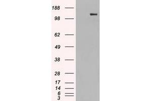 HEK293T cells were transfected with the pCMV6-ENTRY control (Left lane) or pCMV6-ENTRY L1CAM (Right lane) cDNA for 48 hrs and lysed. (L1CAM Antikörper)