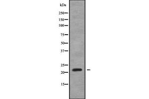 Western blot analysis SAR1A using HeLa whole cell lysates (SAR1A Antikörper  (Internal Region))