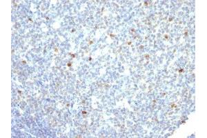 Image no. 2 for Mouse anti-Human IgM antibody (ABIN6155086) (Maus anti-Human IgM Antikörper)