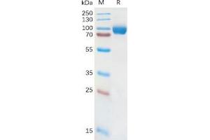 Human IL18RA Protein, hFc Tag on SDS-PAGE under reducing condition. (IL18R1 Protein (Fc Tag))