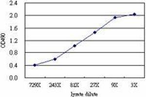 STK33 (Human) Matched Antibody Pair