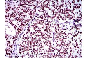Immunohistochemistry (IHC) image for anti-Ring Finger Protein 1 (RING1) (AA 79-263) antibody (ABIN1845880) (RING1 Antikörper  (AA 79-263))