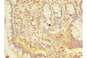 Immunohistochemistry of paraffin-embedded human small intestine tissue using ABIN7170402 at dilution of 1:100 (SNX6 Antikörper  (AA 1-290))