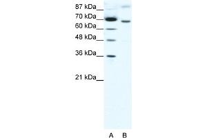 WB Suggested Anti-RACGAP1 Antibody Titration:  1. (RACGAP1 Antikörper  (N-Term))