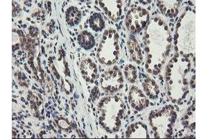 Immunohistochemical staining of paraffin-embedded Human breast tissue using anti-ACBD3 mouse monoclonal antibody. (ACBD3 Antikörper)