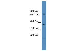 WB Suggested Anti-SF4 Antibody Titration:  0. (Splicing Factor 4 Antikörper  (C-Term))