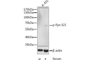 Western blot analysis of extracts of A-431 cells, using Phospho-Fyn-S21 antibody (ABIN6135226, ABIN6136086, ABIN6136087 and ABIN6225545) at 1:1000 dilution. (FYN Antikörper  (pSer21))