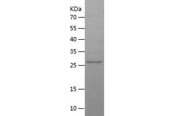 RNLS Protein (AA 23-285) (His tag)