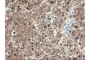 Image no. 3 for anti-Uracil-DNA Glycosylase (UNG) antibody (ABIN1501681)