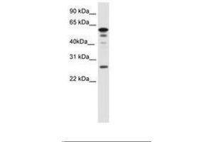Image no. 1 for anti-Forkhead Box D1 (FOXD1) (AA 24-73) antibody (ABIN6736081) (FOXD1 Antikörper  (AA 24-73))