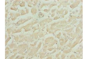 Immunohistochemistry of paraffin-embedded human heart tissue using ABIN7155010 at dilution of 1:100 (HS3ST1 Antikörper  (AA 21-307))