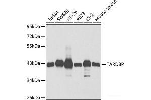 Western blot analysis of extracts of various cell lines using TARDBP Polyclonal Antibody at dilution of 1:1000. (TARDBP Antikörper)