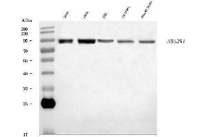 Western blot analysis of RED1/ADARB1 using anti-RED1/ADARB1 antibody (ABIN7600784).