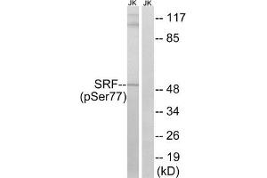 Western blot analysis of extracts from Jurkat cells, treated with PMA (125 ng/mL, 30 mins), using SRF (Phospho-Ser77) antibody. (SRF Antikörper  (pSer77))
