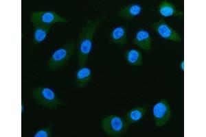 anti-Fatty Acid Binding Protein 5 (Psoriasis-Associated) (FABP5) antibody