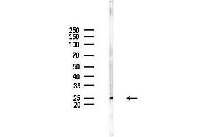 Western blot analysis of lysates from HUVEC cells(UV,30 min treatment), using CACNG1 Antibody at 1/1000 dilution.