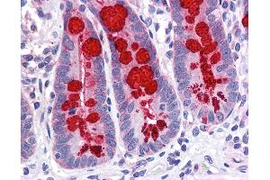 Immunohistochemistry (IHC) image for anti-Solute Carrier Family 9, Subfamily A (NHE3, Cation Proton Antiporter 3), Member 3 Regulator 1 (SLC9A3R1) (AA 252-359) antibody (ABIN790638)