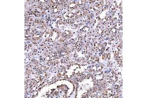 IHC analysis of SCML1 using anti-SCML1 antibody (ABIN7602479).