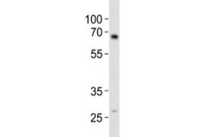 Western blot analysis of lysate from mouse kidney tissue using ALK3 antibody diluted at 1:1000. (BMPR1A Antikörper  (AA 30-60))