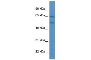 COL8A2 antibody used at 0. (COL8a2 Antikörper  (C-Term))