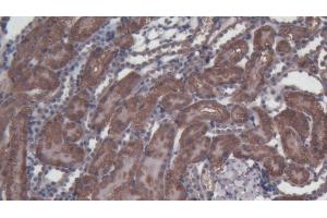Immunohistochemistry (IHC) image for anti-Caspase 3 (CASP3) (AA 29-175) antibody (ABIN7432241)