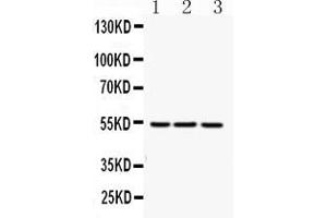 Western blot analysis of FGG expression in rat liver extract ( Lane 1), mouse liver extract ( Lane 2) and HEPG2 whole cell lysates ( Lane 3).