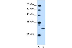 WB Suggested Anti-PDPN Antibody Titration:  0. (Podoplanin Antikörper  (N-Term))