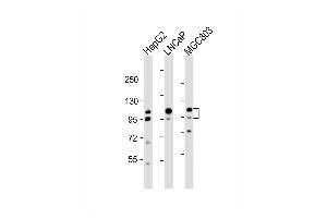 Western Blot at 1:2000 dilution Lane 1: HepG2 whole cell lysate Lane 2: LNCaP whole cell lysate Lane 3: MGC803 whole cell lysate Lysates/proteins at 20 ug per lane. (Anoctamin 7 Antikörper  (N-Term))