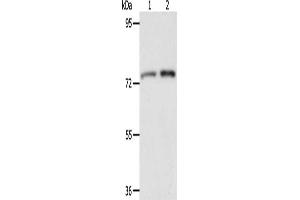 Gel: 8 % SDS-PAGE, Lysate: 40 μg, Lane 1-2: Mouse liver tissue, Mouse kidney tissue, Primary antibody: ABIN7128172(ACOX2 Antibody) at dilution 1/350, Secondary antibody: Goat anti rabbit IgG at 1/8000 dilution, Exposure time: 2 minutes (Acox2 Antikörper)