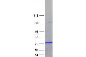 KIAA1143 Protein (KIAA1143) (Myc-DYKDDDDK Tag)