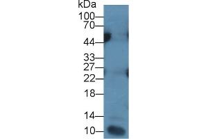 Detection of IL7 in Human Leukocyte lysate using Monoclonal Antibody to Interleukin 7 (IL7) (IL-7 Antikörper  (AA 26-177))